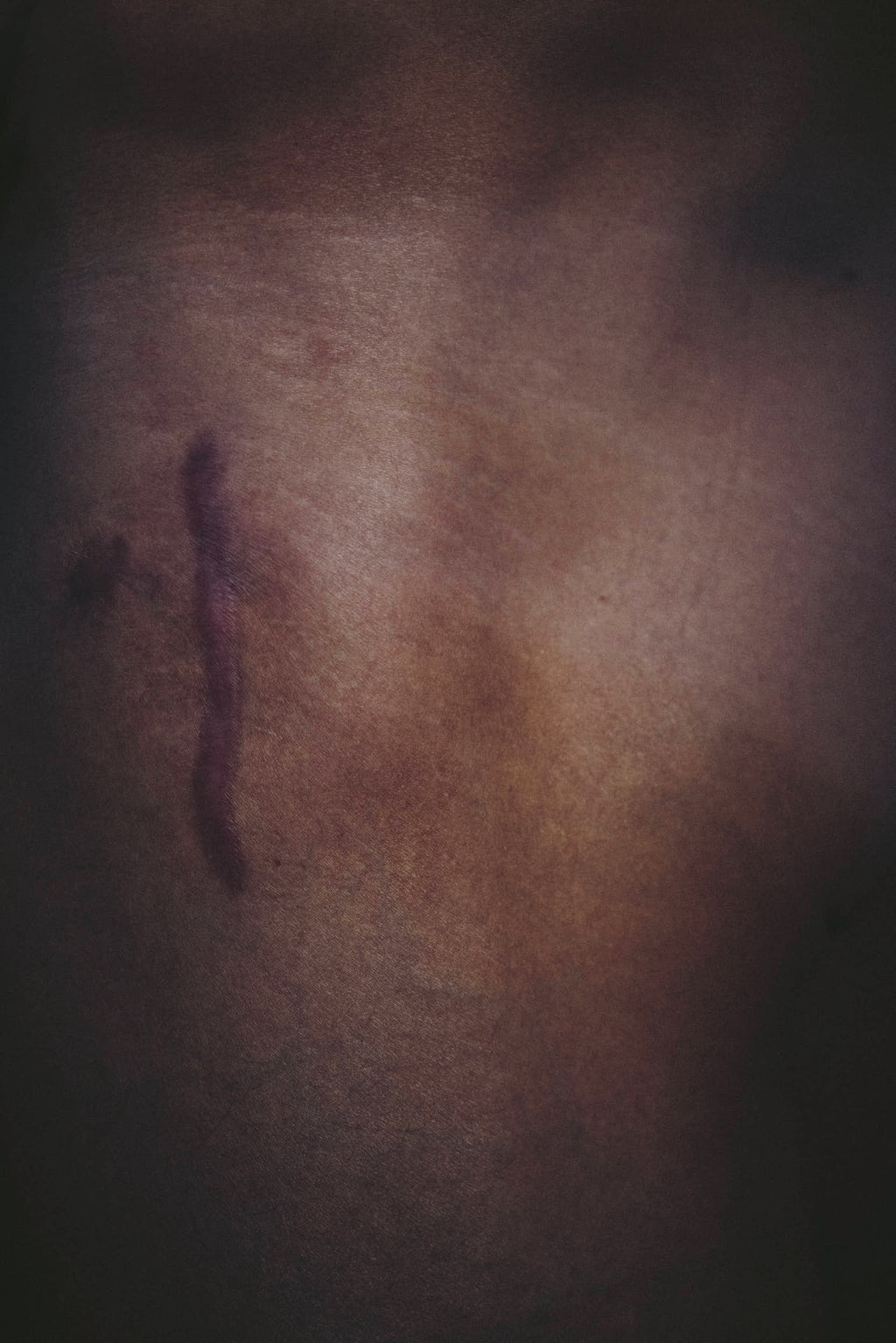 Jan Frodeno, Body Parts I / IV