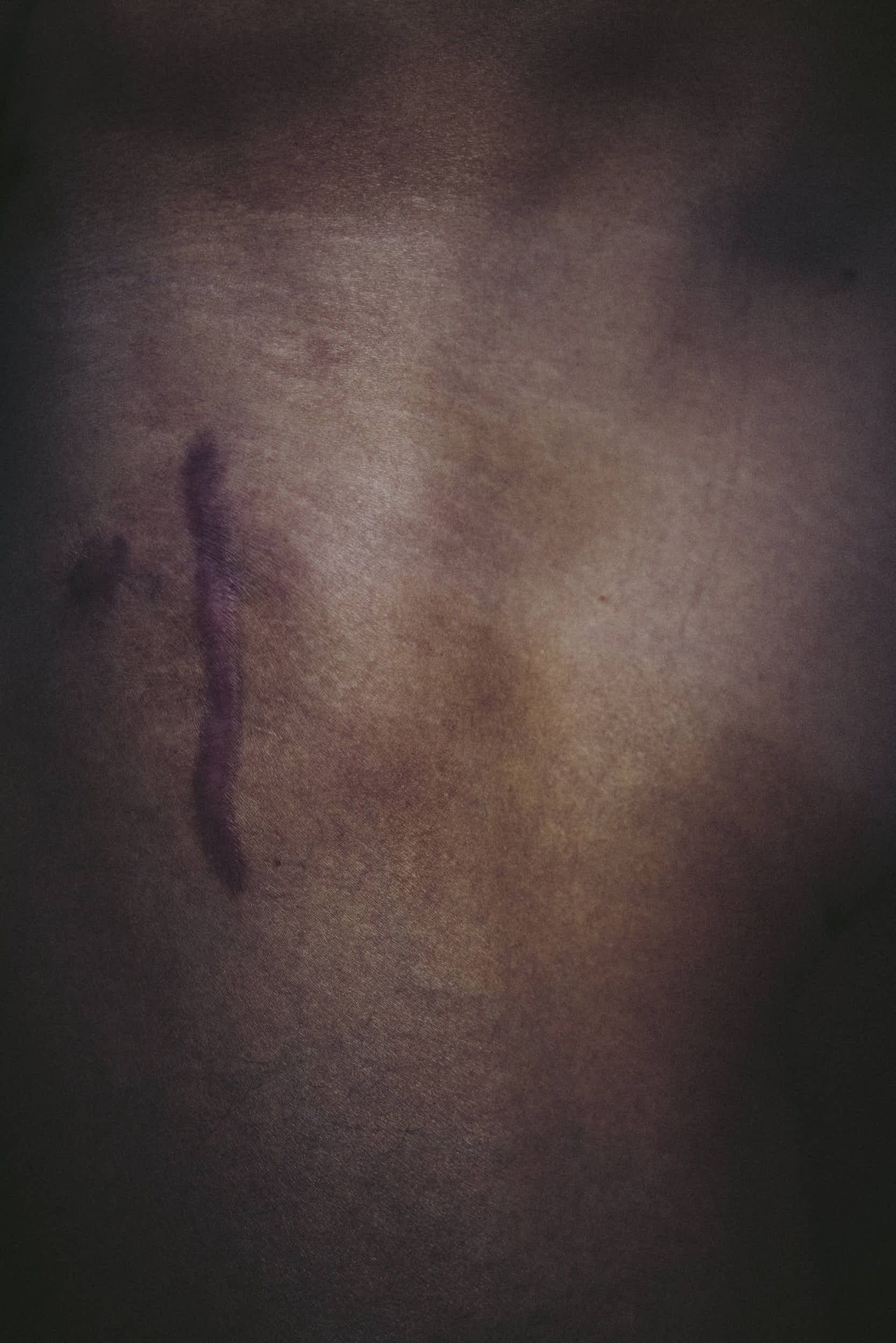 Jan Frodeno, Body Parts I / IV